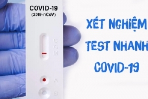 VAI TRÒ CỦA KHÁNG THỂ VÀ ỨNG DỤNG VÀO NGUYÊN LÝ TEST NHANH COVID